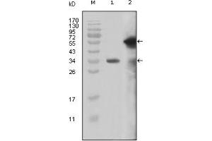 Western Blotting (WB) image for anti-Myeloid/lymphoid Or Mixed-Lineage Leukemia (MLL) (AA 3751-3968) antibody (ABIN2464083) (MLL/KMT2A Antikörper  (AA 3751-3968))