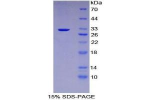 SDS-PAGE analysis of Mouse Kruppel Like Factor 4, Gut (KLF4) Protein. (KLF4 Protein)
