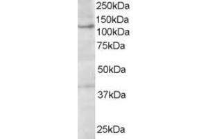 Western Blotting (WB) image for anti-Hermansky-Pudlak Syndrome 3 (HPS3) (C-Term) antibody (ABIN2465825)
