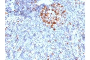Formalin-fixed, paraffin-embedded human Tonsil stained with Cdk1 Mouse Monoclonal Antibody (A17. (CDK1 Antikörper  (C-Term))