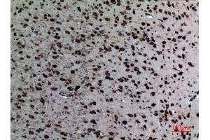 Immunohistochemical analysis of paraffin-embedded Mouse-brain, antibody was diluted at 1:100.