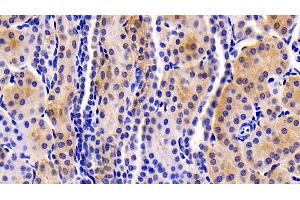 Immunohistochemistry (IHC) image for anti-Neuropilin 1 (NRP1) (AA 646-814) antibody (ABIN7425992)