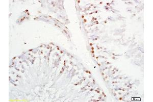 Formalin-fixed and paraffin embedded rat testis labeled with Anti-XAGE2 Polyclonal Antibody, Unconjugated (ABIN721750) at 1:200 followed by conjugation to the secondary antibody and DAB staining. (XAGE2 Antikörper  (AA 30-70))