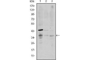 Western blot analysis using CD1A mouse mAb against K562 (1), RAJI (2), and MOLT4 (3) cell lysate. (CD1a Antikörper)