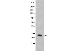 Western blot analysis GAAP using HepG2 whole cell lysates (TMBIM4 Antikörper  (N-Term))