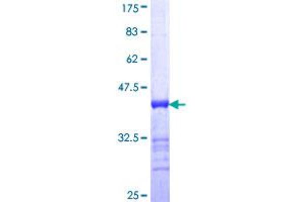 AKAP4 Protein (AA 1-100) (GST tag)