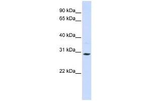 SLC25A20 antibody used at 1 ug/ml to detect target protein. (SLC25A20 Antikörper)