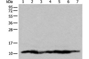 Western blot analysis of 293T cell lysates using UQCRQ Polyclonal Antibody at dilution of 1:450 (UQCRQ Antikörper)