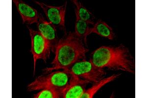 Histone H4K8ac antibody (pAb) tested by immunofluorescence.
