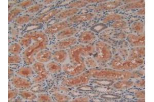 IHC-P analysis of Human Kidney Tissue, with DAB staining. (ADCY3 Antikörper  (AA 501-736))