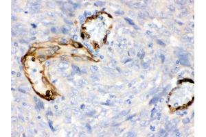 Immunohistochemistry (Paraffin-embedded Sections) (IHC (p)) image for anti-Indoleamine 2,3-Dioxygenase 1 (IDO1) (AA 37-69), (N-Term) antibody (ABIN3043857) (IDO1 Antikörper  (N-Term))