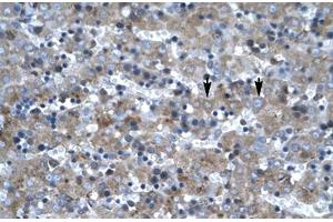 Immunohistochemical staining (Formalin-fixed paraffin-embedded sections) of human liver with LHX6 polyclonal antibody .