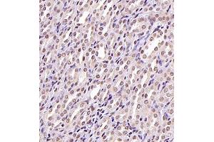 Immunohistochemistry of paraffin embedded rat kidney using USP34 (ABIN7076115) at dilution of 1:700 (400x lens)