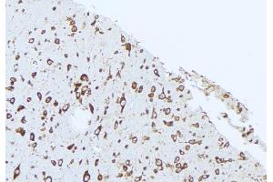 ABIN6274857 at 1/100 staining Rat brain tissue by IHC-P. (Apolipoprotein L 2 Antikörper  (C-Term))