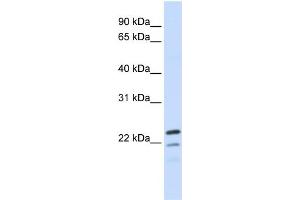 WB Suggested Anti-REEP1 Antibody Titration:  0. (Receptor Accessory Protein 1 Antikörper  (Middle Region))