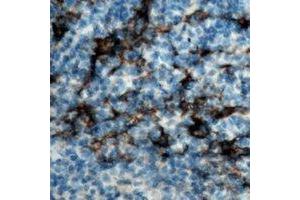 Immunohistochemical analysis of CD19 staining in human tonsil formalin fixed paraffin embedded tissue section. (CD19 Antikörper)