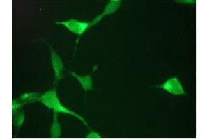 Immunofluorescence (IF) image for anti-Prostate Specific Antigen (PSA) antibody (ABIN1502669) (Prostate Specific Antigen Antikörper)