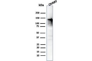 Western Blot Analysis of human Ovary tissue using Caldesmon Mouse Monoclonal Antibody (h-CALD). (Caldesmon Antikörper)