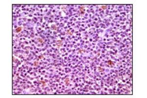 Immunohistochemistry (IHC) image for anti-Induced Myeloid Leukemia Cell Differentiation Protein Mcl-1 (MCL1) antibody (ABIN1844302) (MCL-1 Antikörper)