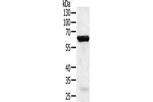 Western Blotting (WB) image for anti-TNF Receptor-Associated Factor 5 (TRAF5) antibody (ABIN2824855) (TRAF5 Antikörper)