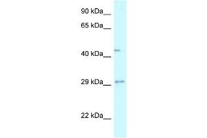 WB Suggested Anti-FUT8 Antibody Titration: 1. (FUT8 Antikörper  (N-Term))