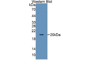 Detection of Recombinant KLRK1, Mouse using Polyclonal Antibody to Killer Cell Lectin Like Receptor Subfamily K, Member 1 (KLRK1)