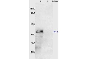 Lane 1: mouse kidney lysates Lane 2: mouse lung lysates probed with Anti AVPR2 Polyclonal Antibody, Unconjugated (ABIN747848) at 1:200 in 4 °C.