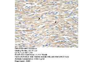 Rabbit Anti-LMX1A Antibody  Paraffin Embedded Tissue: Human Muscle Cellular Data: Skeletal muscle cells Antibody Concentration: 4. (LMX1A Antikörper  (Middle Region))