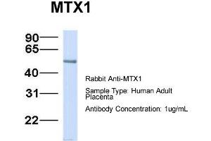 Host:  Rabbit  Target Name:  MTX1  Sample Type:  Human Adult Placenta  Antibody Dilution:  1. (Metaxin 1 Antikörper  (C-Term))