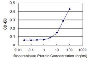 Detection limit for recombinant GST tagged TUBB is 1 ng/ml as a capture antibody.
