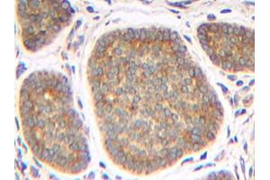 Image no. 1 for anti-Tumor Necrosis Factor (Ligand) Superfamily, Member 13 (TNFSF13) antibody (ABIN465418) (TNFSF13 Antikörper)