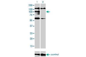 Western blot analysis of NBR1 over-expressed 293 cell line, cotransfected with NBR1 Validated Chimera RNAi (Lane 2) or non-transfected control (Lane 1). (NBR1 Antikörper  (AA 2-96))
