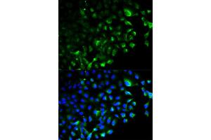 Immunofluorescence analysis of HeLa cell using TRAF2 antibody. (TRAF2 Antikörper)