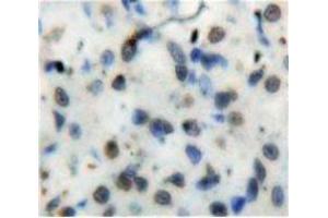 Used in DAB staining on fromalin fixed paraffin-embedded Stomach tissue (Nuclear Factor kappa B2 (AA 38-343) Antikörper)