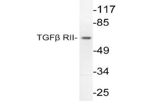 Image no. 1 for anti-Transforming Growth Factor, beta Receptor II (70/80kDa) (TGFBR2) antibody (ABIN271848) (TGFBR2 Antikörper)