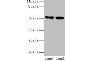 Western blot All lanes: KRT8 antibody at 2 μg/mL Lane 1: A549 whole cell lysate Lane 2: MCF-7 whole cell lysate Secondary Goat polyclonal to rabbit IgG at 1/10000 dilution Predicted band size: 54, 57 kDa Observed band size: 54 kDa (KRT8 Antikörper  (AA 2-483))