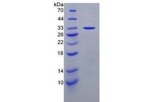SDS-PAGE analysis of Human Laminin alpha 3 Protein. (LAMA3 Protein)