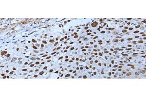 Immunohistochemistry (Paraffin-embedded Sections) (IHC (p)) image for anti-Zinc Finger, HIT-Type Containing 3 (ZNHIT3) antibody (ABIN7248236)
