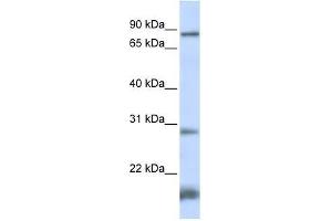 SMYD4 antibody used at 0. (SMYD4 Antikörper  (N-Term))