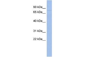 WB Suggested Anti-ZNF233 Antibody Titration:  0.