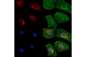 ABIN6262924 and ABIN6277599 staining  cells(UV treatment) by IF/ICC. (Lamin B Receptor Antikörper  (Internal Region))