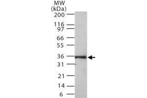 Western blot analysis of MKI67IP in 30 ugs of Ramos cell lysate. (NIFK Antikörper  (AA 100-200))