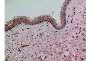 Immunohistochemistry (IHC) analysis of paraffin-embedded Human Skin, antibody was diluted at 1:100. (IL-1 beta Antikörper  (Internal Region))