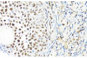 Immunohistochemistry of paraffin-embedded Rat ovary using BACH1 Polyclonal Antibody at dilution of 1:100 (40x lens). (BACH1 Antikörper)