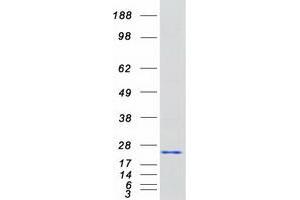 Western Blotting (WB) image for LIM Domain Only 3 (Rhombotin-Like 2) (LMO3) (Transcript Variant 1) protein (Myc-DYKDDDDK Tag) (ABIN2730876)