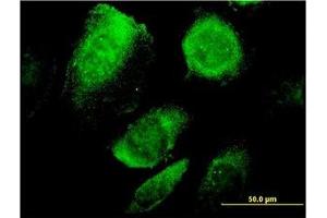 Image no. 1 for anti-B-Cell Receptor-Associated Protein 29 (BCAP29) (AA 125-241) antibody (ABIN599278) (BCAP29 Antikörper  (AA 125-241))