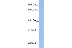 WB Suggested Anti-LPIN1 Antibody Titration: 0. (Lipin 1 Antikörper  (N-Term))