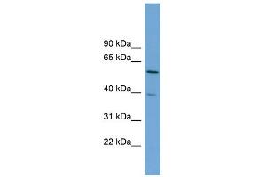WB Suggested Anti-TOM1 Antibody Titration: 0. (TOM1 Antikörper  (Middle Region))