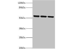 Western blot All lanes: MYOT antibody at 2 μg/mL Lane 1: 293T whole cell lysate Lane 2: HepG2 whole cell lysate Lane 3: Mouse skeletal muscle tissue Secondary Goat polyclonal to rabbit IgG at 1/10000 dilution Predicted band size: 56, 36 kDa Observed band size: 56 kDa (Myotilin Antikörper  (AA 443-498))