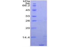 SDS-PAGE (SDS) image for Apolipoprotein C-I (APOC1) ELISA Kit (ABIN6730889)